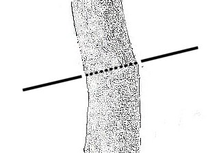 threadgrafting bonsai